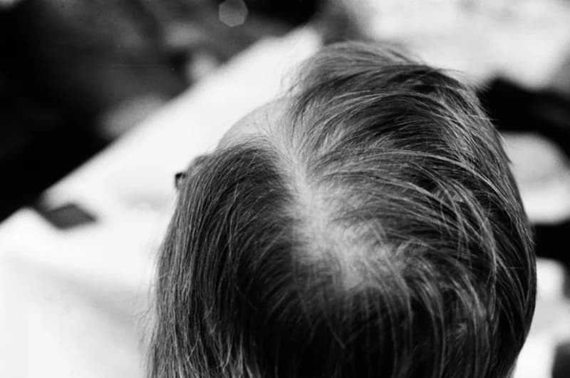 Bayer aszpirin - az Újvidéki Színház előadása